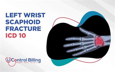 Left Wrist Scaphoid Fracture Icd 10 Codes Ucontrol Billing