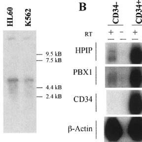 Expression Of Hpip Mrna A Northern Blot Analysis Of Poly A Rna