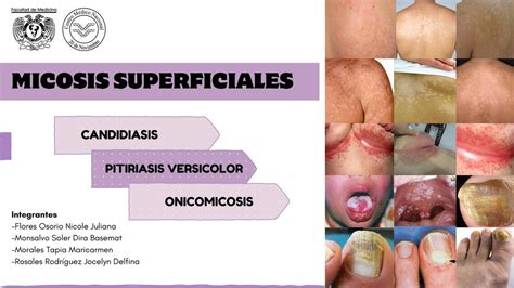 Micosis Superficiales Candidiasis Y Pitiriasis Dira Monsalvo UDocz