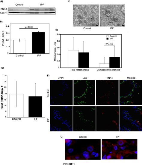 PINK1 Expression And Mitochondrial Dysfunction In IPF Lung Tissue A