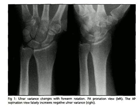 Ce Rt Radiographic Positioning Of The Wrist For X Ray Technologists