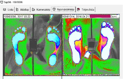 Ingyenes számítógépes taplvizsgálat gyerekeknek A Nő Örök