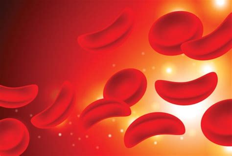 Sickle Cell Disease What You Need To Know Central Florida Health Care