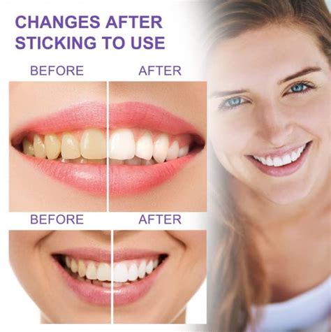 Teeth Sensitive Whitening And Stain Removing Toothpaste Odor Control