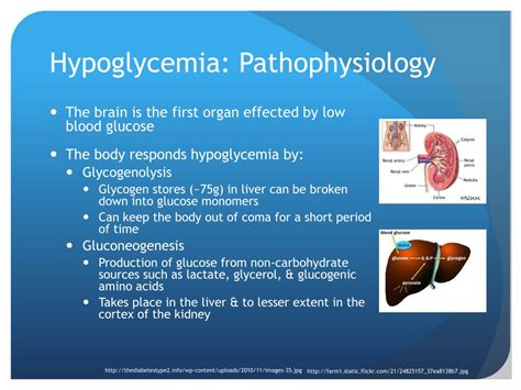 Ppt Hypoglycemia And Hyperglycemia Powerpoint Presentation Free