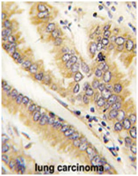 ANTI-AGR2 ANTIBODY 400UL