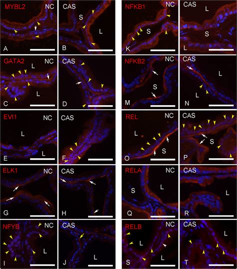 Tf Localization In Epithelial And Stroma Cells Immunohistochemical