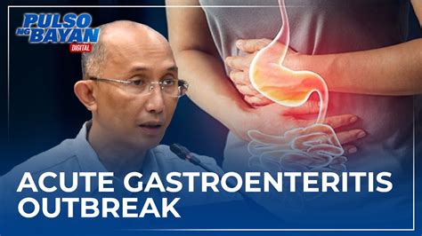 Baguio City Nag Deklara Ng Acute Gastroenteritis Outbreak Youtube