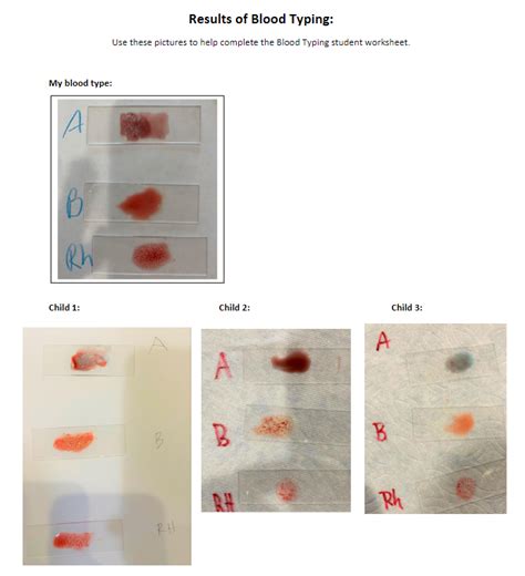 Solved Blood Typing LabObjectives Review ABO And Rh Blood Chegg