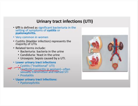 Uti Flashcards Quizlet