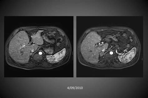 Radiology Basics Ppt