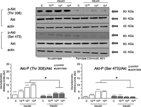 Western Blot Analysis For Akt P At Ser473 And Thr308 Western Blots