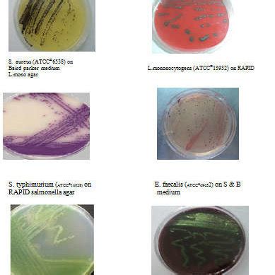 Pdf Antibacterial Activity Of Bougainvillea Variegata Ethanolic And