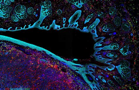 World cancer research day 2023: 6 brilliant cancer research breakthroughs