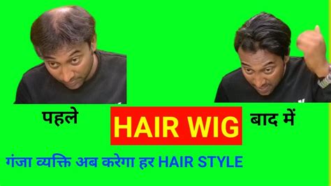 Hair Wig In Patna Ii Hair Patch In Patna Ii Hair Bonding In Patna Ii