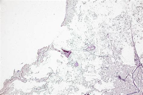 Motor Neuron, Spinal Cord, Nerve Fibres and Nerve Cells Under the ...