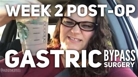 Two Weeks Post Op Rny Gastric Bypass Surgery Youtube