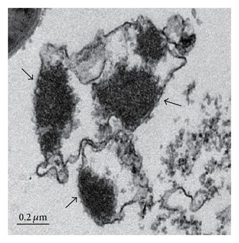 Transmission Electron Microscopy Images Of Skn Treated Mrsa Atcc