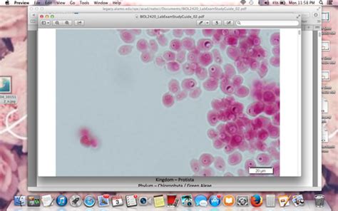 Micro Lab Test 2 Flashcards Quizlet