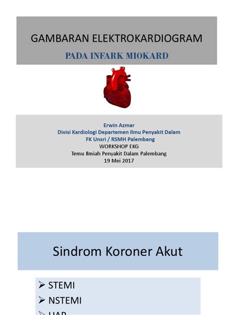 Gambaran Ekg Infark Miokard Dr Erwin A Pdf Ventricle Heart Diastole