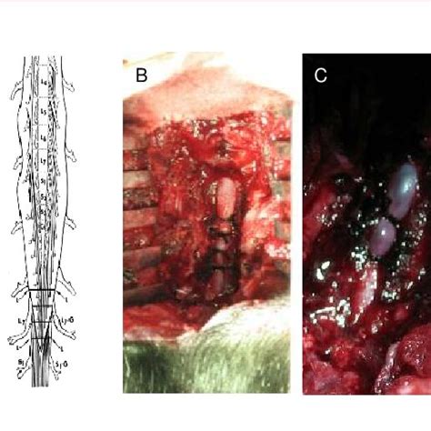 Procedure For The Establishment Of Multiple Protracted Cauda Equina