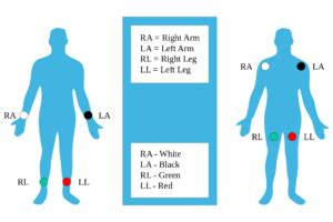 The Ultimate 12-Lead ECG Placement Guide (With Illustrations)