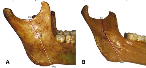 PDF Evaluación de la Anatomía Mandibular Relacionada con la