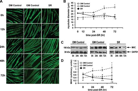 Serum Reduction Sr Reduces Myotube Diameter And Myosin Heavy Chain