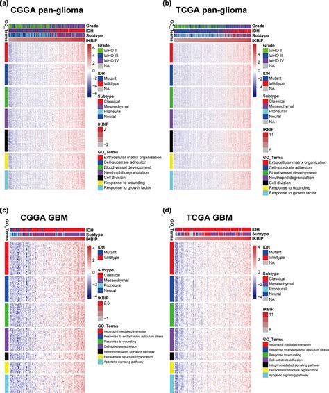 Ikbip Is A Novel Emt Related Biomarker And Predicts Poor Survival In Glioma