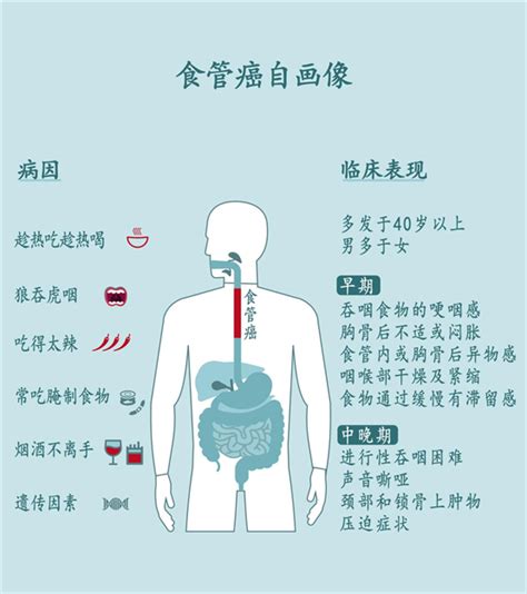 食管癌专家相加庆坐诊上海孟超肿瘤医院 中华网