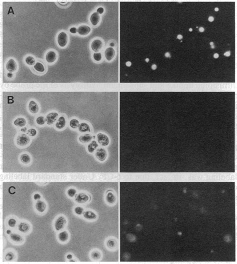 Vacuolar Labeling With Quinacrine Cells Were Labeled With Quinacrine