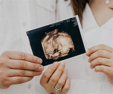 Ultrasonido En Salud Digna Precio Y Consulta De Resultados