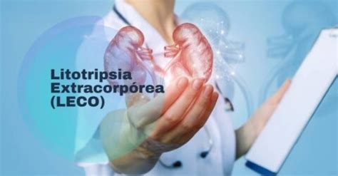 Litotripsia Extracorpórea LECO para tratamento de Cálculos Renais