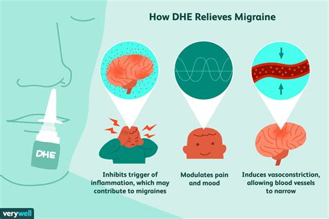 Ways To Cure A Migraine