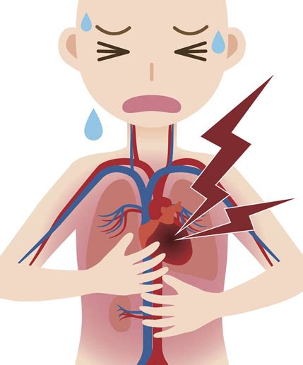 DOLOR TORÁCICO QUE ES Y CÓMO SE REALIZA LA ATENCIÓN