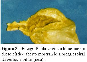 Scielo Brasil Estudo Anatomotopogr Fico Das Vias Biliares Extra