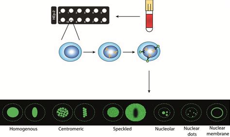 Principles And Staining Patterns Of Indirect Immunofluorescence