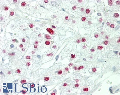 Ihc Plus Crtc Mect Torc Monoclonal Antibody Rabbit Lsbio