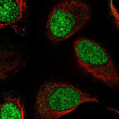 Rabbit Polyclonal Anti Rsbn1 Antibody Buy For Research Highly