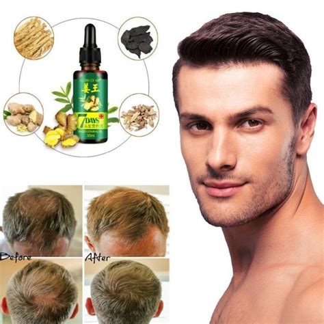 7 Days Hair Regrowth Serum Hair Nutrient Solution Natural Hair