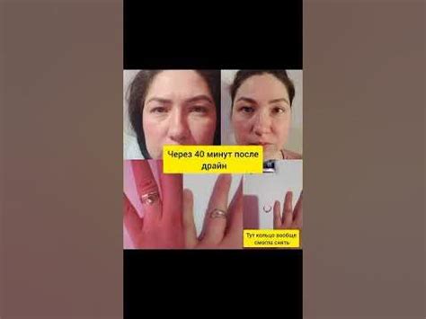 как избавиться от отеков? #драйн #отеки #худею - YouTube