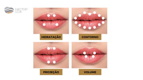 Preenchimento Labial Injectors Club