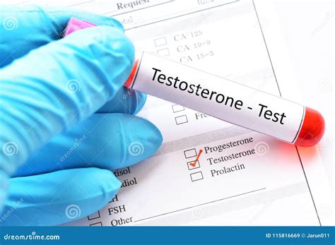 Testosterone hormone test stock image. Image of penis - 115816669