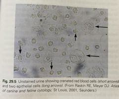 Chapter 29 Urine Sediment Analysis Flashcards Quizlet