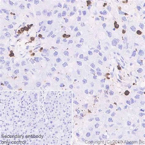 Macrophage Marker