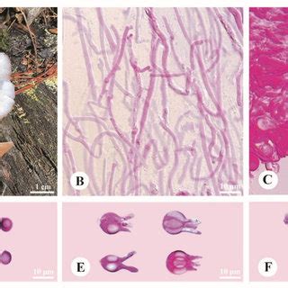 Basidiomata And Microscopic Structures Of Pseudohydnum Sinogelatinosum