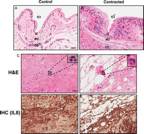 Hematoxylin And Eosin H E Staining Of Control And Contracted Breast