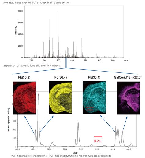 Maldi Imaging Mass Spectrometry Imaging