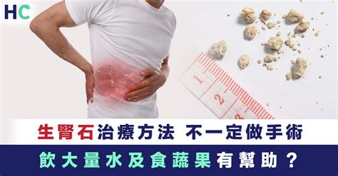 【生腎石】腎石治療方法 飲大量水及食蔬果有幫助？ Health Concept