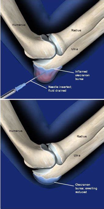 Archway Orthopedics